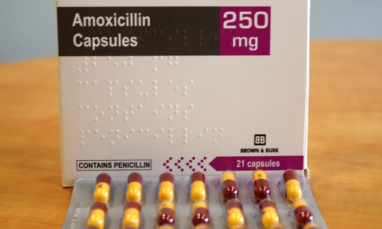 Amoxicillin for Toothache Pain